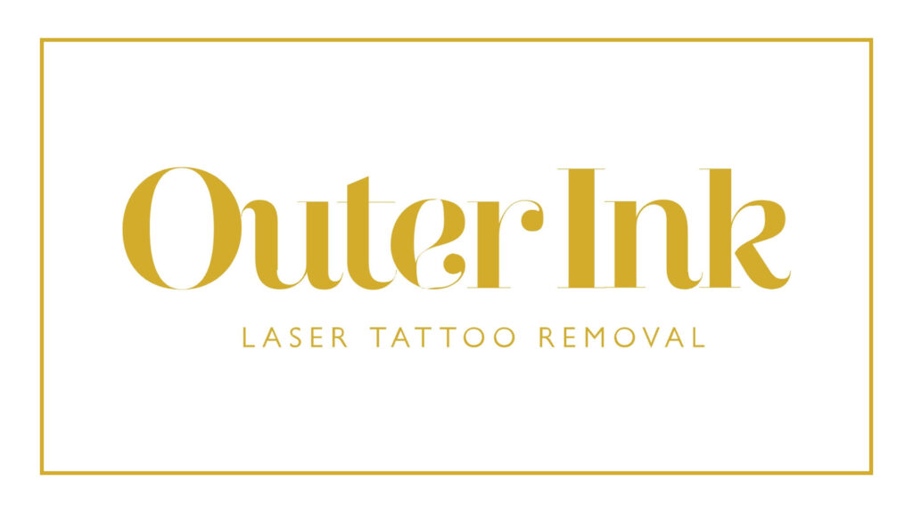 outer-ink-laser-tattoo-removal